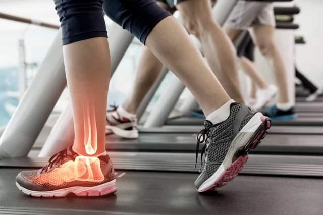 tarsal-tunnel-syndrome